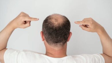 Provillus tratamento capilar contra queda de cabelo masculino