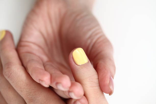 Tratamento de fungos nas unhas com o Acidophilis Beer Soak