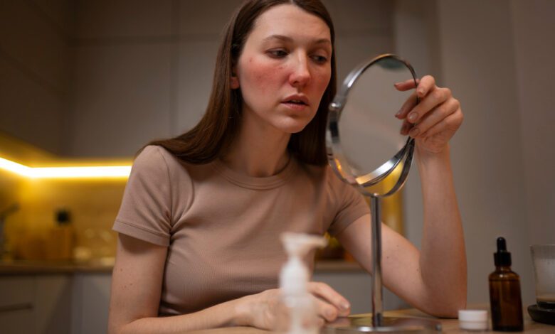 Uma visão geral equilibrada do tratamento da pele com acne Produtos Epiclear
